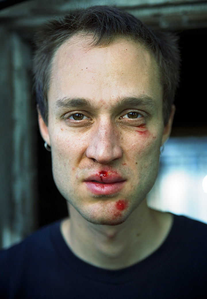 [broken+face+copy.jpg]