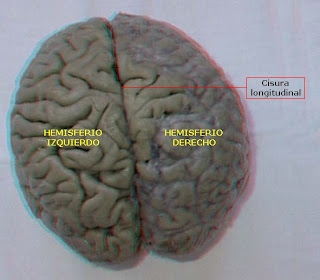 el cerebro presenta hendiduras profundas llamadas cisuras o fisuras. La mayor de ellas es la cisura longitudinal o interhemisférica, que divide al telencéfalo en dos hemisferios, uno derecho y otro izquierdo.