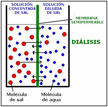 diálisis