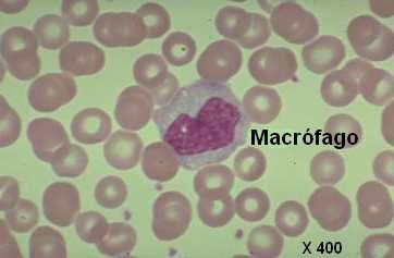 leucocito macrófago