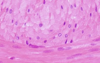 Fibra muscular lisa