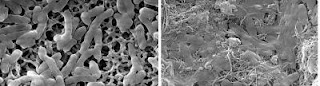 Caption: E.coli incubated for one hour on support matrix in the absence (1) or in the presence (2) of nanotubes. Credit: Yale University. Usage Restrictions: Use with credit given.