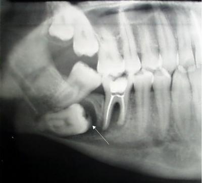 [molars.jpg]