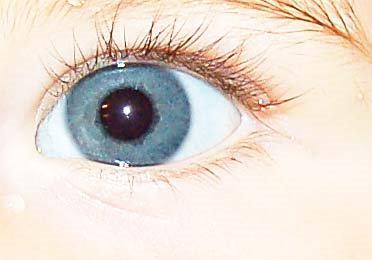 [zebrahoernchen_auge2.jpg]