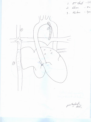 Heart Drawings and Explanations
