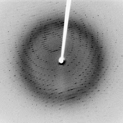 X-ray diffraction image