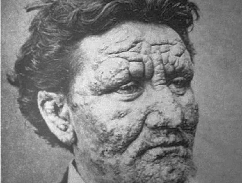 Case of the Day: Nine-Banded Armadillo