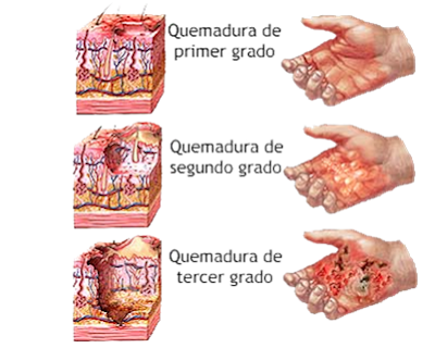 bienestar bienestar
