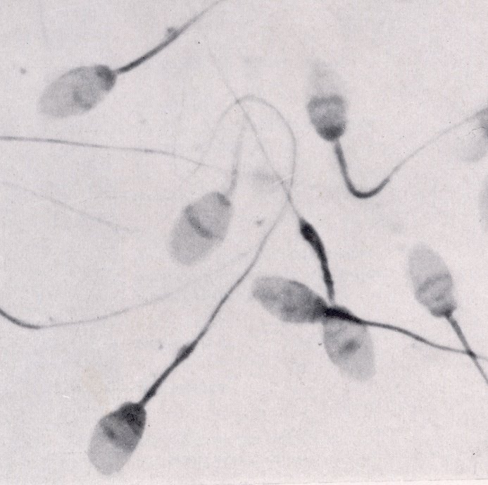 [sperm.jpg]