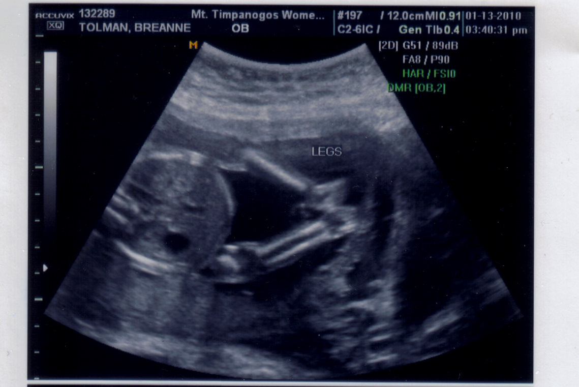 [baby+#3+Ultrasound.jpg]
