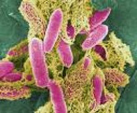 Avoiding the Urinary Tract Infection