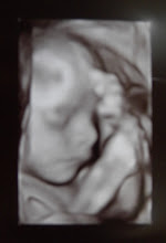 26 week ultrasound