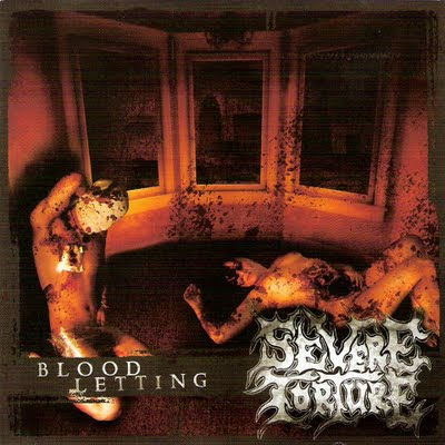 http://4.bp.blogspot.com/_Ualhp1Z_dwI/StJfV4oMgMI/AAAAAAAAAVU/C_AGFDKOs8o/s400/Severe+Torture+-+Blood+Letting.jpg
