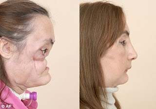 connie culp before being shot and after