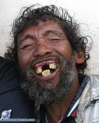 funny pictures terrible smile no teeth