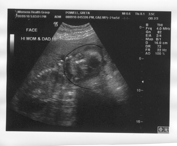 Powell's Pound 21 1/2 week ultrasound