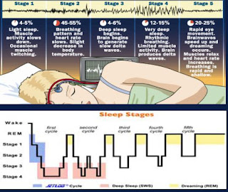 المشى اثناء النوم Sleep+stages+1
