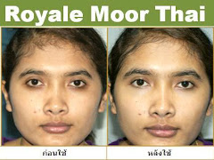 ผู้ใช้ Royale Moor Thai 6