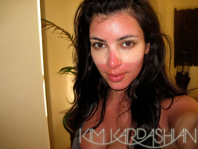 The Product That Saved Kim Kardashians Sunburned Skin kim+kardashian+sunburn The Product That Saved Kim Kardashians Sunburned Skin