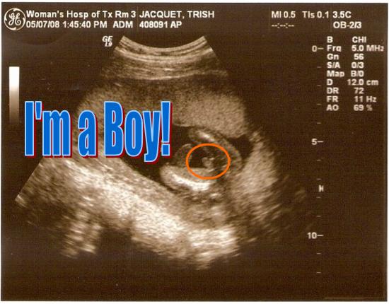 [boy.JPG]