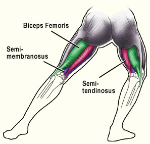 Hamstring repeämä oireet