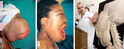 [16+poundfacetumor.jpg]