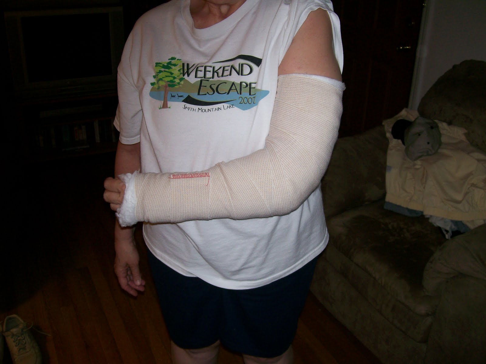 azoyizes and MS Cubital Nerve