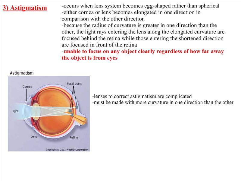 Vision Defects Defects Of Vision. Vision Defects