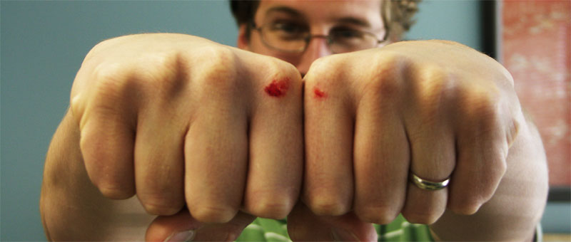 [Bloody-Knuckles.jpg]