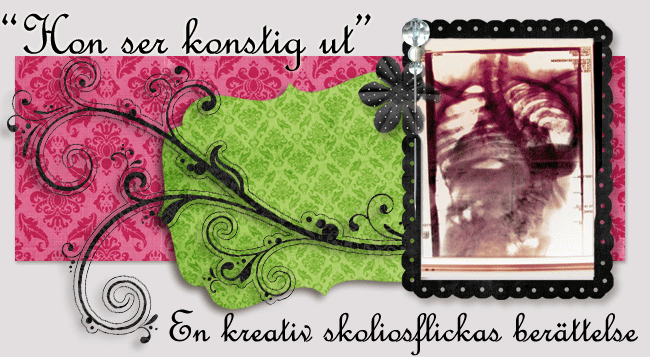 "Hon ser konstig ut" - en kreativ skoliosflickas berättelse