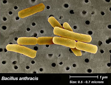 carbunco antrax bacteriano epidemiologiaescobar debe bacillus escobar epidemiologia
