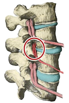 [graphic_subluxation.gif]