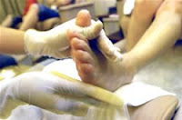 El hongo en los pies se rasca el tratamiento