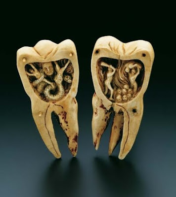  ... for what causes tooth decay was the tooth worm first noted by