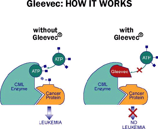 Imatinib gleevec