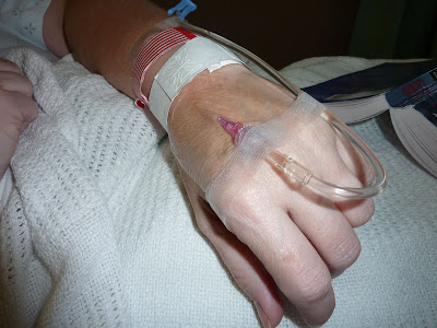Iv Tube