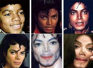 Michael Jackson Plastic Surgery on Michael Jackson Plastic Surgery 300px Jpg