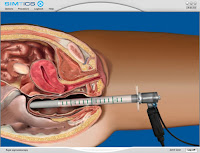 Sigmoidoscopy Rigid Sigmoidoscopy | RM. Sigmoidoscopy Rigid Sigmoidoscopy | RM.