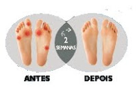 Oriflame Creme para a Pele Seca e Calosidades FootCare