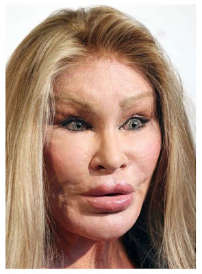 Celebrity Plastic Surgery on Plastic Surgery Before And After  Cat Woman Plastic Surgery