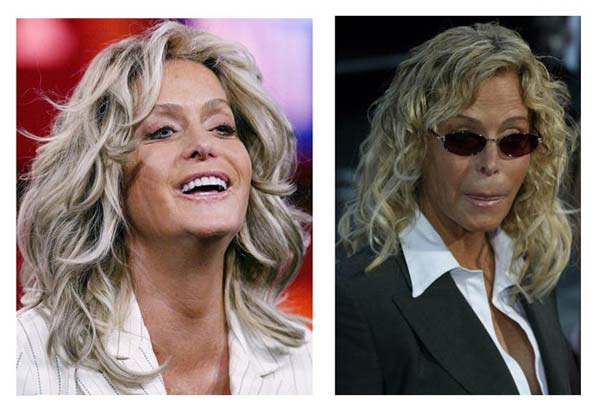 Facial farrah fawcett picture plastic surgery Do married men jerk off