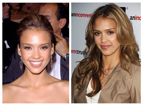 [JessicaAlbaPlasticSurgery.jpg]