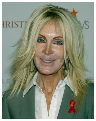 Joan Van Ark Bad Nose Job