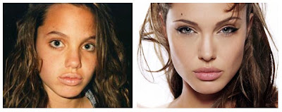 Angelina Jolie Plastic Surgery