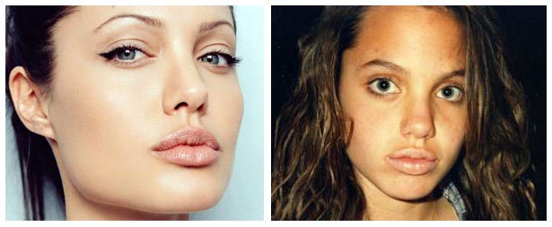 angelina jolie plastic surgery nose. Angelina Jolie Nose Surgery