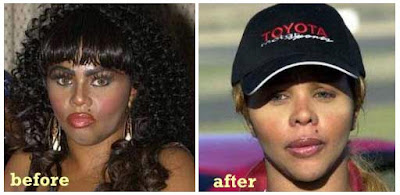 Lil Kim Before After