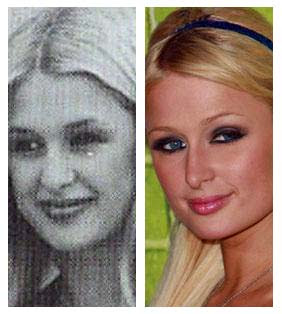 Ryan Reynolds Nose on Paris Hilton Plastic Surgery Nose Job Image Hosted By Http