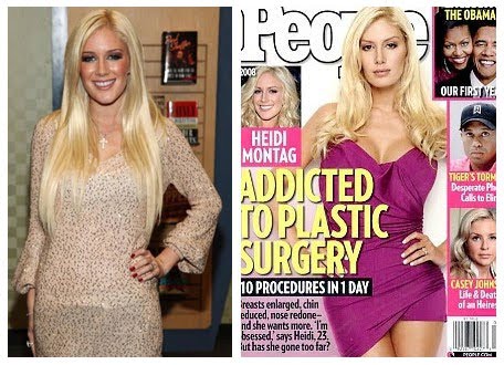 Heidi Montag Plastic Surgery heidi montag before and after plastic surgery 2010. Heidi Montag Plastic Surgery