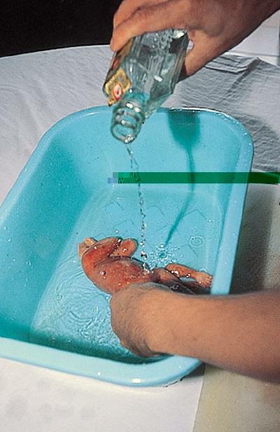 [fetus-soup-in-china-5.jpg]