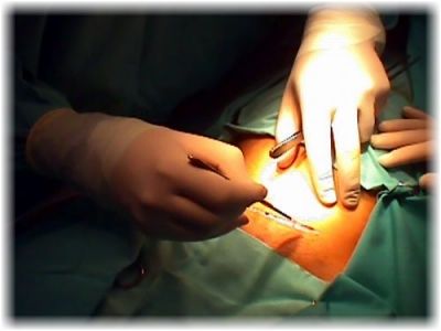 VIDEOS OPERACION videos operacion: